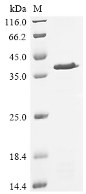 Recombinant Saccharomyces cerevisiae Actin-related protein 5 (ARP5), partial (CSB-EP001252SVG)