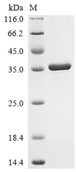 Recombinant Drosophila melanogaster Spectrin beta chain (beta-Spec), partial (CSB-EP251598DLU)