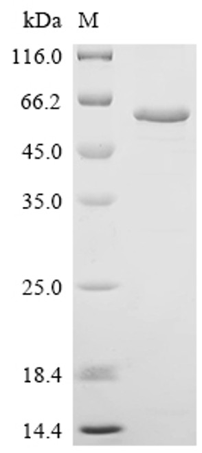 Recombinant Human Copper-transporting ATPase 2 (ATP7B), partial (CSB-EP002415HU)