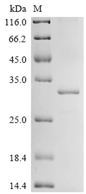 Recombinant Drosophila melanogaster Clathrin heavy chain (Chc), partial (CSB-EP333472DLU)