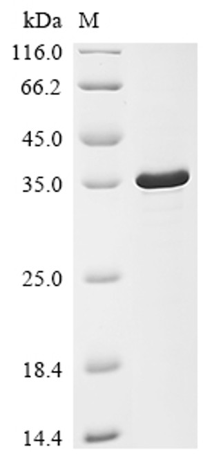 Recombinant Human T-cell leukemia virus 1 HTLV-1 basic zipper factor (HBZ) (CSB-EP314490HQG)