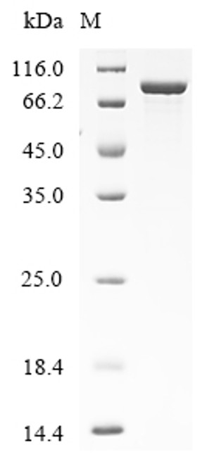 Recombinant Human Endogenous retrovirus group K member 113 Gag polyprotein (HERVK_113) (CSB-EP352942HUc7)