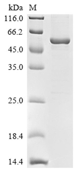 Recombinant Human Cyclin-G-associated kinase (GAK), partial, Biotinylated (CSB-EP009190HUm5-B)
