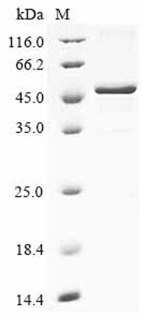 Recombinant Human Kelch domain-containing protein 3 (KLHDC3) (CSB-EP858414HUa0)