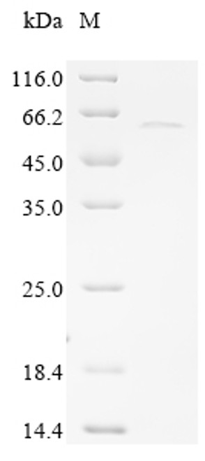 Recombinant Human Sarcoplasmic/endoplasmic reticulum calcium ATPase 2 (ATP2A2), partial (CSB-EP002333HUc7)
