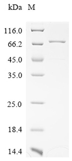Recombinant Human Creatine kinase M-type (CKM) (CSB-EP005459HUc0)