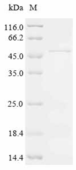 Recombinant Human Dual specificity mitogen-activated protein kinase kinase 3 (MAP2K3) (CSB-EP013412HUh2)