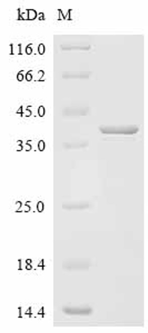 Recombinant Bordetella pertussis Pertussis toxin subunit 1 (ptxA) (CSB-EP356423BUAa6)