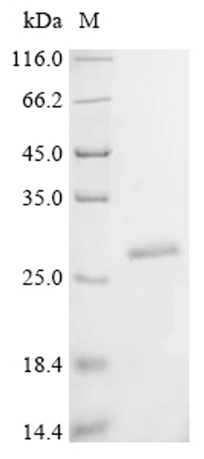 Recombinant Human Lysine-specific demethylase 6B (KDM6B), partial (CSB-EP517674HU)