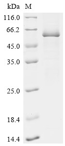Recombinant Human Bactericidal permeability-increasing protein (BPI) (CSB-EP002783HU)