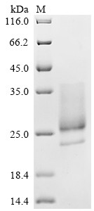 Recombinant Cowpox virus CPXV099 protein (CPXV099 CDS), partial (CSB-MP5088CRG)