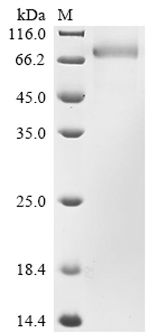 Recombinant Human Growth arrest-specific protein 6 (GAS6) (CSB-MP619872HUd7)