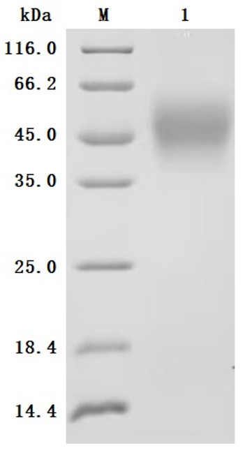Recombinant Human Interleukin-4 receptor subunit alpha (IL4R), partial, Biotinylated (Active) (CSB-MP011661HU2-B)
