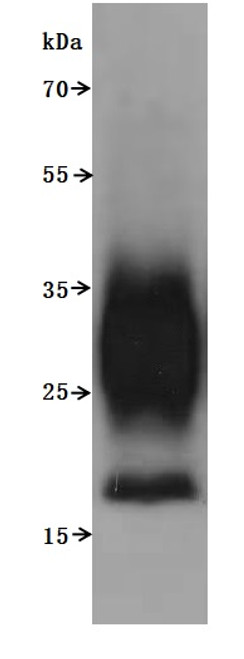 Recombinant Macaca fascicularis Transmembrane 4 L6 family member 1 (TM4SF1)-VLPs (Active) (CSB-MP5031MOV) Recombinant Macaca fascicularis Transmembrane 4 L6 family member 1 (TM4SF1)-VLPs (Active) (CSB-MP5031MOV)