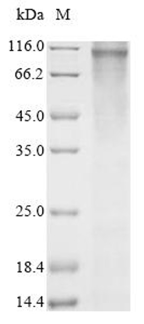 Recombinant Human Wolframin (WFS1) (CSB-CF026100HU(A4))