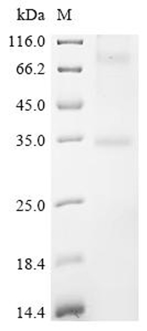 Recombinant Human Olfactory receptor 52D1 (OR52D1) (CSB-CF887970HU)
