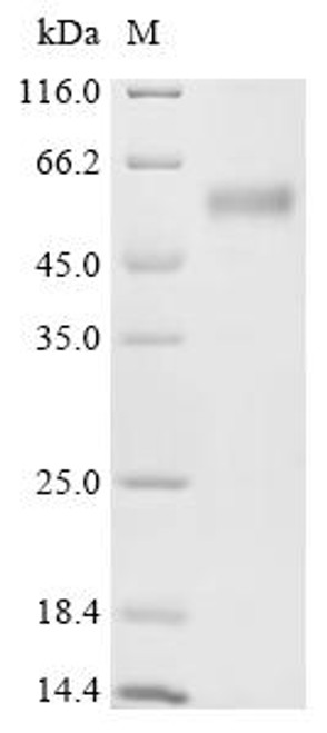 Recombinant Rabbit T cell immunoreceptor with Ig and ITIM domains (TIGIT), partial (CSB-MP5047RB)