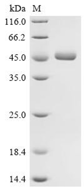 Recombinant Human Interleukin-2 (IL2), Biotinylated (CSB-MP011629HU-B)