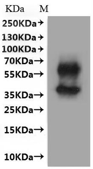 Recombinant Mouse B-lymphocyte antigen CD20 (Ms4a1)-VLPs (CSB-MP015007MO)