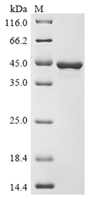 Recombinant Solanum tuberosum Patatin-15 (CSB-EP640821FIG)