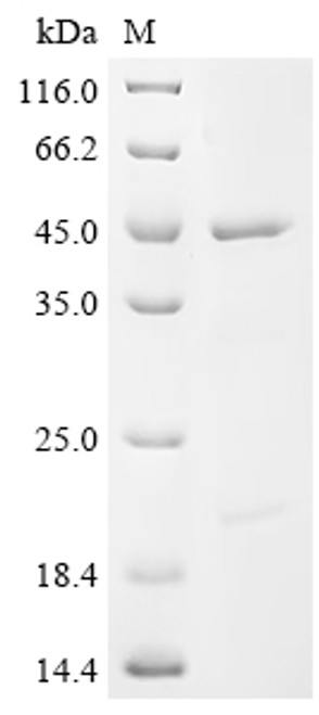 Recombinant Human Eukaryotic initiation factor 4A-I (EIF4A1) (CSB-EP007550HUe1)