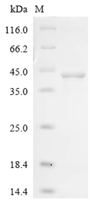 Recombinant Vaccinia virus Protein OPG190 (OPG190), partial (CSB-EP312446VAIn3)