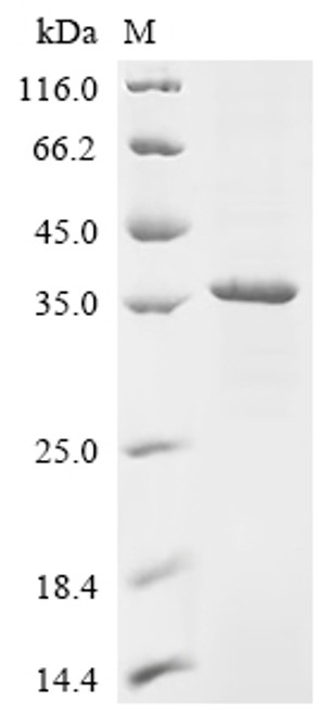 Recombinant Rat Lutropin-choriogonadotropic hormone receptor (Lhcgr), partial (CSB-EP012911RAf2)