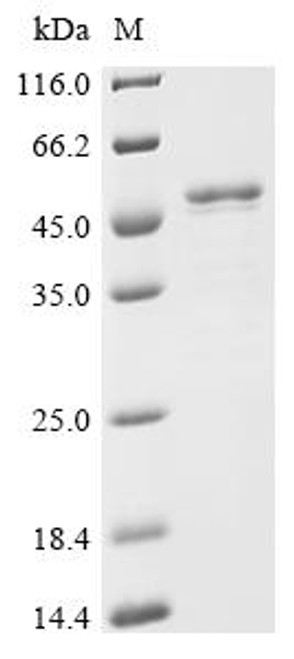 Recombinant Human Splicing factor U2AF 65 kDa subunit (U2AF2) (CSB-EP025408HUe0)
