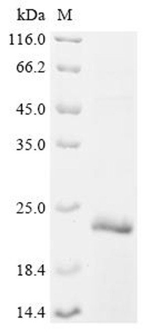 Recombinant Human Complement receptor type 1 (CR1), partial (CSB-EP005932HUe1)