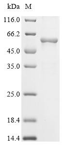 Recombinant Tick-borne encephalitis virus European subtype Genome polyprotein, partial (CSB-EP318509TEM)