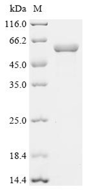 Recombinant Human POU domain, class 2, transcription factor 3 (POU2F3) (CSB-EP892135HU)