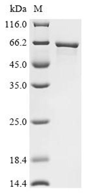 Recombinant Human E3 ubiquitin-protein ligase makorin-1 (MKRN1) (CSB-EP883390HU)