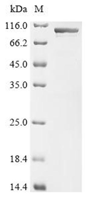 Recombinant Mouse Heat shock protein HSP 90-alpha (Hsp90aa1) (CSB-EP010802MO)