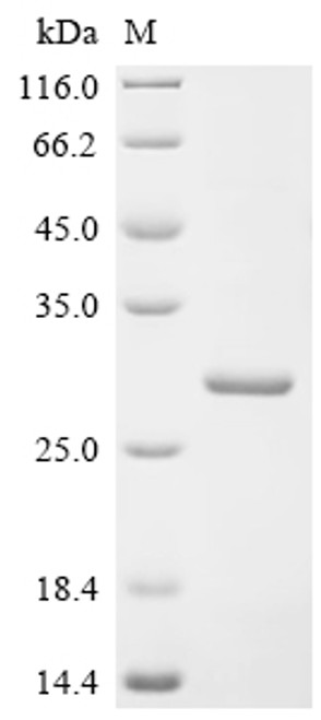Recombinant Human Hepcidin (HAMP), partial (CSB-EP010124HUe0) Recombinant Human Hepcidin (HAMP), partial (CSB-EP010124HUe0)