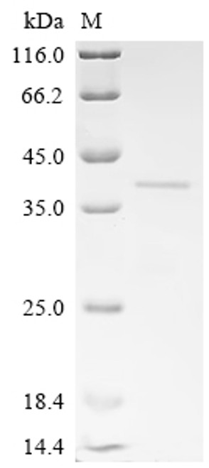 Recombinant Mouse Platelet endothelial aggregation receptor 1 (Pear1), partial (CSB-EP017765MO4)