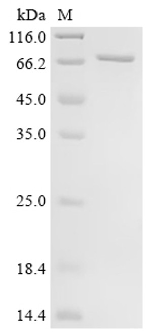 Recombinant Human T-box transcription factor TBX21 (TBX21) (CSB-EP890744HU)