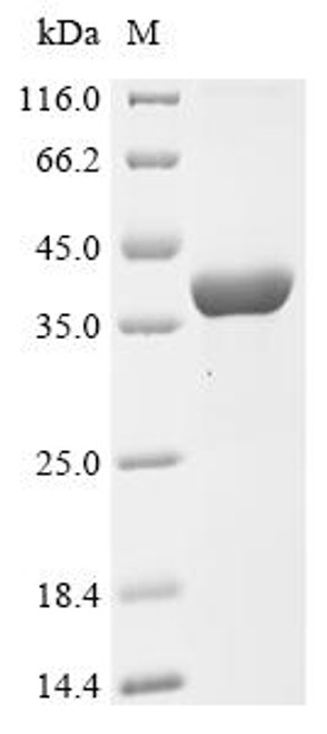 Recombinant Mouse Interferon-induced 35 kDa protein homolog (Ifi35) (CSB-EP887549MO)