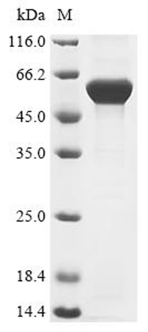Recombinant Ophiophagus hannah L-amino-acid oxidase (CSB-EP011660OEL)