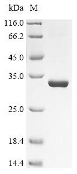 Recombinant Macrovipera lebetina Chymotrypsin-like protease VLCTLP (CSB-EP522192MPJ)