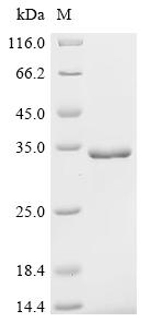Recombinant Human herpesvirus 6A Envelope glycoprotein L (gL) (CSB-EP345605HJZ)