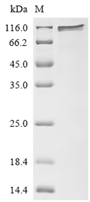 Recombinant Human Disks large homolog 4 (DLG4) (CSB-EP006938HU)