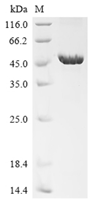 Recombinant Human herpesvirus 6B Envelope glycoprotein B (gB), partial (CSB-EP327525HKAc7)