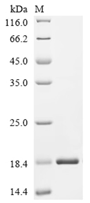 Recombinant Human Calponin-2 (CNN2), partial (CSB-EP860764HUb1)