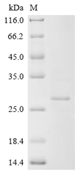 Recombinant Human cytomegalovirus Protein UL16 (UL16), partial (CSB-EP325853HWV)