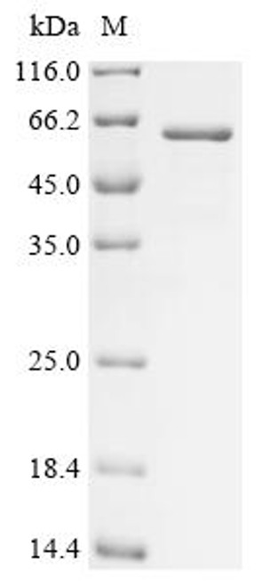 Recombinant Echis carinatus Zinc metalloproteinase-disintegrin-like ecarin (CSB-EP845861EAH)