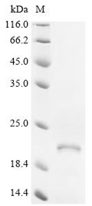 Recombinant Human G-protein coupled receptor family C group 5 member B (GPRC5B), partial (CSB-EP868367HU1)