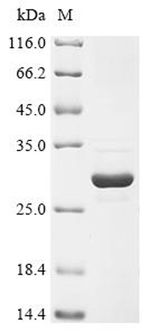 Recombinant Human Phosphatidylinositol 4,5-bisphosphate 3-kinase catalytic subunit alpha isoform (PIK3CA), partial (CSB-EP017998HU) Recombinant Human Phosphatidylinositol 4,5-bisphosphate 3-kinase catalytic subunit alpha isoform (PIK3CA), partial (CSB-EP017998HU)