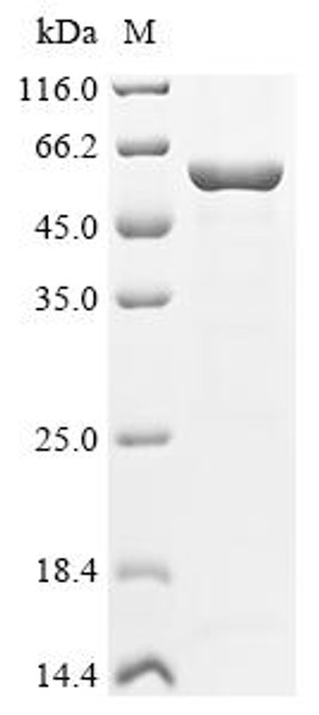 Recombinant Human V-type proton ATPase subunit B,brain isoform (ATP6V1B2) (CSB-EP002398HU) Recombinant Human V-type proton ATPase subunit B,brain isoform (ATP6V1B2) (CSB-EP002398HU)