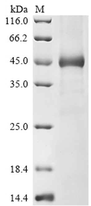 Recombinant Human Ubl carboxyl-terminal hydrolase 18 (USP18) (CSB-EP891559HU) Recombinant Human Ubl carboxyl-terminal hydrolase 18 (USP18) (CSB-EP891559HU)