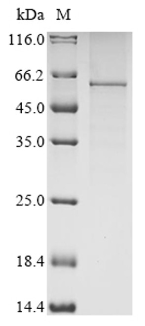 Recombinant Human Leucine-rich glioma-inactivated protein 1 (LGI1) (CSB-BP012898HU)